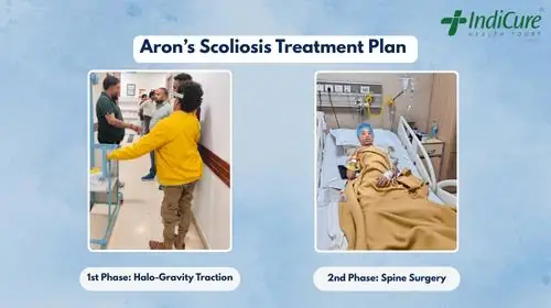 A two-part image showing Aron's scoliosis treatment plan. The first phase shows him undergoing Halo-Gravity Traction, and the second phase shows him in a hospital bed after his spine surgery.
